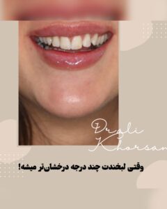 کلینیک دندانپزشکی دکتر علی خرسند نوبهار، دندانپزشکی طرف قرارداد با بیمه کارآفرین در تهران، نمونهکارهای درمانی