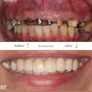 کلینیک دندانپزشکی دکتر علی خرسند نوبهار، دندانپزشکی طرف قرارداد با بیمه سامان در تهران، نمونهکارهای درمانی