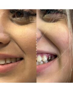 دکتر هومن بختیارکیا جراح دندانپزشک و ایمپلنتولوژیست، دندانپزشکی طرف قرارداد با بیمه تجارت نو در تهران، نمونهکارهای درمانی و زیبایی