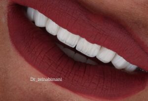 دندانپزشکی دکتر زینب ایمانی، دندانپزشکی طرف قرارداد با بیمه ملت در تهران، خدمات ترمیمی و زیبایی دندان در قیطریه