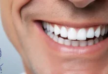 دندانپزشکی طرف قرارداد با بیمه بانک ملی در تهران