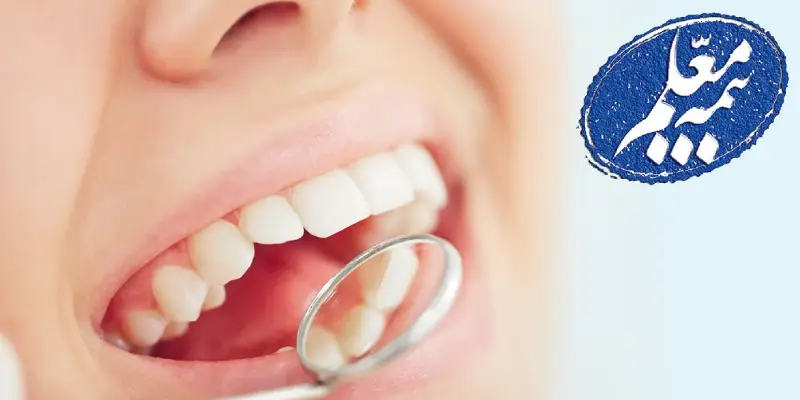 دندانپزشکی طرف قرارداد با بیمه معلم در شرق تهران