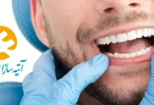 دندانپزشکی طرف قرارداد با بیمه اتیه سازان حافظ در غرب تهران