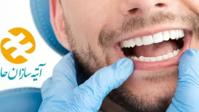 دندانپزشکی طرف قرارداد با بیمه اتیه سازان حافظ در غرب تهران