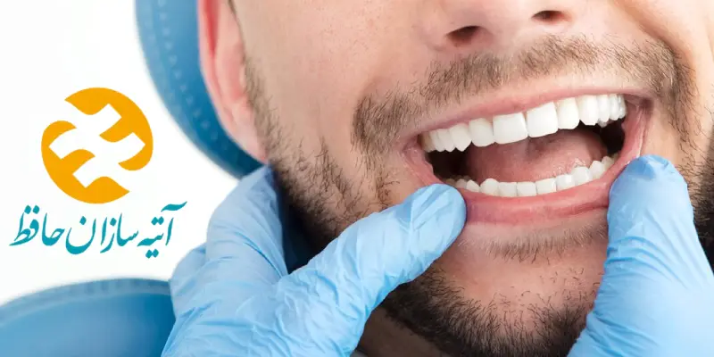 دندانپزشکی طرف قرارداد با بیمه اتیه سازان حافظ در غرب تهران