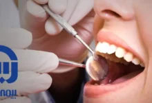 دندانپزشکی طرف قرارداد با بیمه اسیا در غرب تهران