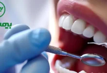 دندانپزشکی طرف قرارداد با بیمه البرز در غرب تهران