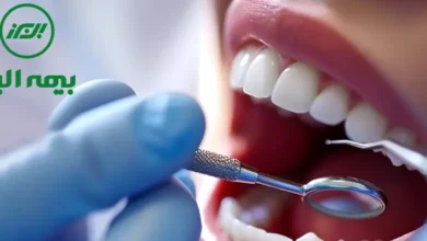 دندانپزشکی طرف قرارداد با بیمه البرز در غرب تهران