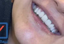 دندانپزشکی طرف قرارداد با بیمه رازی در غرب تهران