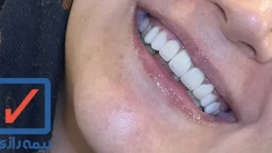 دندانپزشکی طرف قرارداد با بیمه رازی در غرب تهران