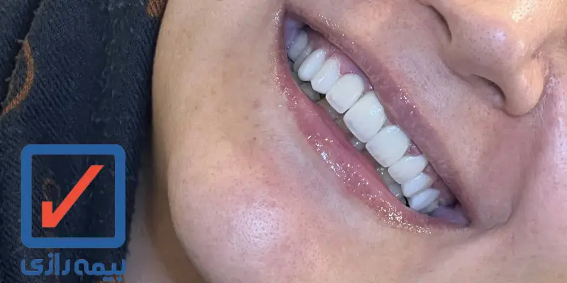 دندانپزشکی طرف قرارداد با بیمه رازی در غرب تهران