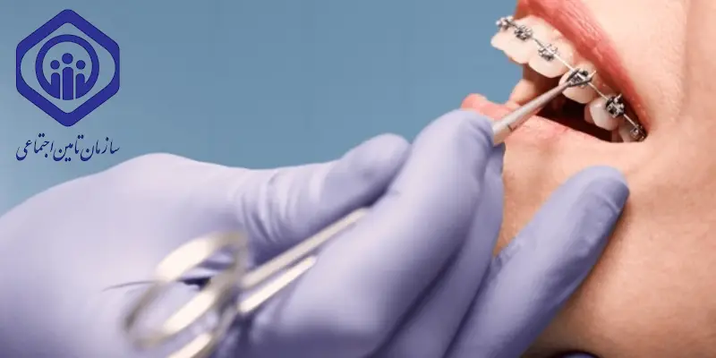 دندانپزشکی طرف قرارداد با بیمه تامین اجتماعی در غرب تهران