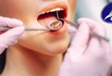 دندانپزشکی طرف قرارداد با بیمه معلم در کرج